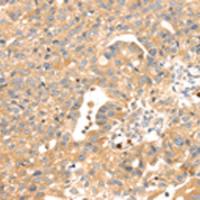 兔抗S100A12多克隆抗体