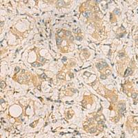 兔抗ZDHHC3多克隆抗体