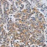 兔抗CLEC14A多克隆抗体