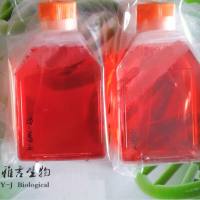 ASH-3人甲状腺未分化癌