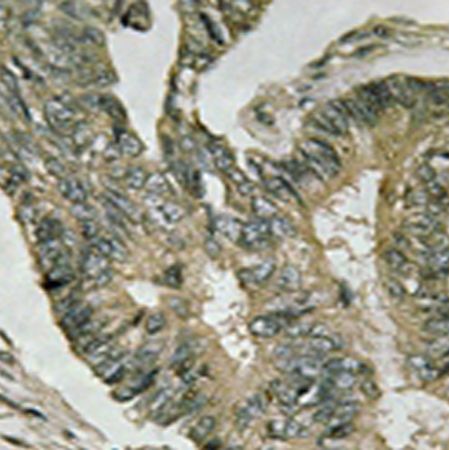 兔抗ALDOC多克隆抗体