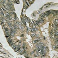 兔抗ALDOC多克隆抗体