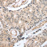 兔抗TRNAU1AP多克隆抗体