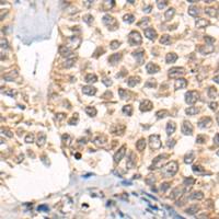 兔抗CHRNA6多克隆抗体