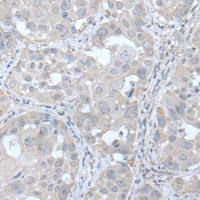 兔抗UBE2Q2多克隆抗体