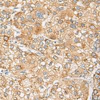 兔抗CRABP1多克隆抗体