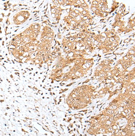兔抗E2F8多克隆抗体