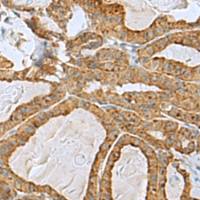 兔抗RPL10A多克隆抗体