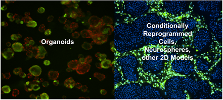 ATCC 类器官资源 -- 宝贵的临床前癌症研究模型