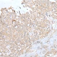 兔抗DOK6多克隆抗体