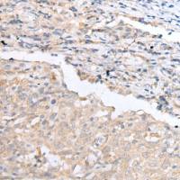 兔抗CCR4多克隆抗体