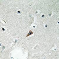 兔抗PTK2B(Phospho-Tyr579)多克隆抗体