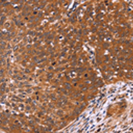 兔抗CDC37L1多克隆抗体