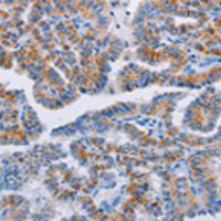 兔抗BCL2A1多克隆抗体