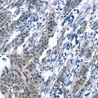 兔抗BNIP3L多克隆抗体