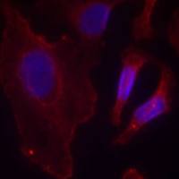 兔抗PLCG2 (Phospho-Tyr753)多克隆抗体