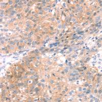 兔抗SNAP23多克隆抗体