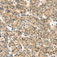 兔抗TMEM161A多克隆抗体