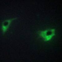 兔抗MAP4K4多克隆抗体