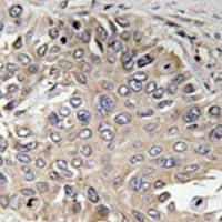 兔抗SPTBN5多克隆抗体