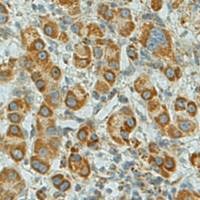 兔抗SFTPA1多克隆抗体