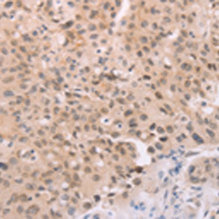 兔抗ADAM11多克隆抗体