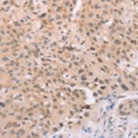 兔抗ADAM11多克隆抗体