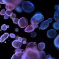 ATCC类器官资源和培养用Kit产品-宝贵的临床前癌症研究模型