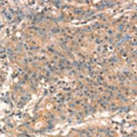 兔抗STK17A多克隆抗体