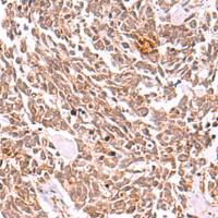 兔抗COPS3多克隆抗体