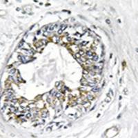 兔抗PAK1(Ab-199)多克隆抗体