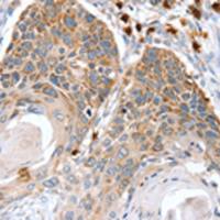 兔抗RNF185多克隆抗体