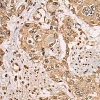 兔抗BEX1多克隆抗体