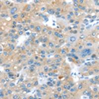 兔抗ERP44多克隆抗体