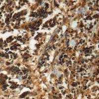 兔抗GAN多克隆抗体