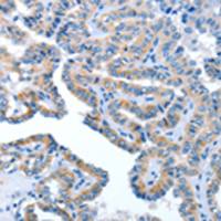 兔抗AMDHD2多克隆抗体