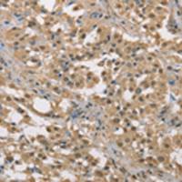 兔抗DACH2多克隆抗体