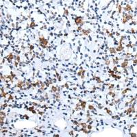 兔抗HCRT多克隆抗体