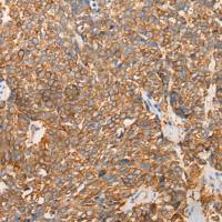 兔抗CARMIL1多克隆抗体