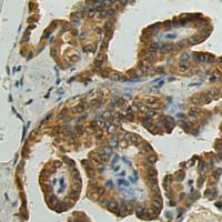 兔抗GSTZ1多克隆抗体