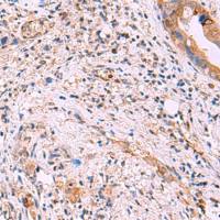 兔抗ZAP70多克隆抗体