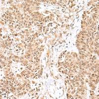 兔抗GLI2多克隆抗体