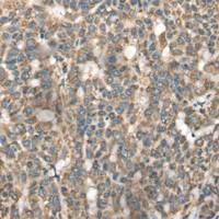 兔抗BLNK多克隆抗体