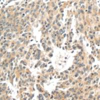 兔抗FBXO34多克隆抗体