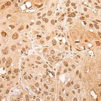 兔抗CHRAC1多克隆抗体