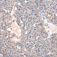 兔抗FZR1多克隆抗体