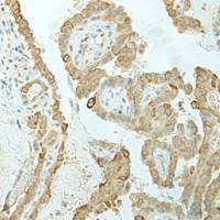 兔抗ETAA1多克隆抗体