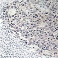 兔抗COL9A3多克隆抗体