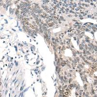 兔抗MBD2-b多克隆抗体