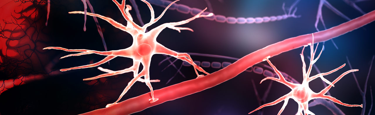 GFAP：星形胶质细胞活化标志物和新兴血清生物标志物